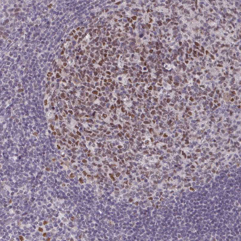 Anti-MLH1 Antibody