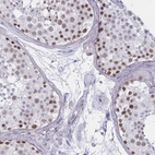 Immunohistochemical staining of human testis shows strong nuclear positivity in cells in seminiferous ducts.