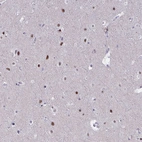 Immunohistochemical staining of human cerebral cortex shows strong nuclear positivity in neurons.