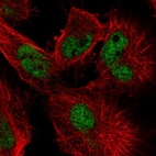 Immunofluorescent staining of human cell line U-251 MG shows localization to nucleoplasm.