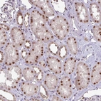 Anti-SWSAP1 Antibody