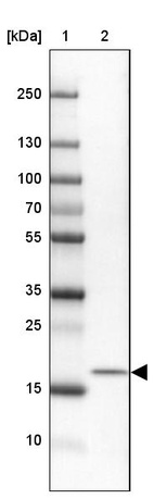 Lane 1: Marker [kDa] 250, 130, 100, 70, 55, 35, 25, 15, 10_br/_Lane 2: Human Cerebral Cortex tissue
