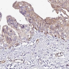 Anti-EHD4 Antibody