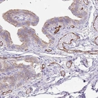 Immunohistochemical staining of human fallopian tube shows strong positivity in endothelial cells.