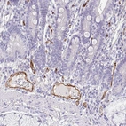 Immunohistochemical staining of human duodenum shows strong positivity in endothelial cells.