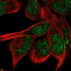 Immunofluorescent staining of human cell line RH-30 shows localization to nucleus & nucleoli.