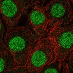 Immunofluorescent staining of human cell line MCF7 shows localization to nucleus & nucleoli.
