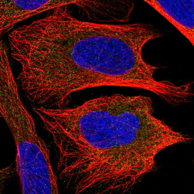 Anti-CHMP2B Antibody