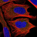 Anti-CHMP2B Antibody
