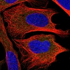 Anti-CHMP2B Antibody