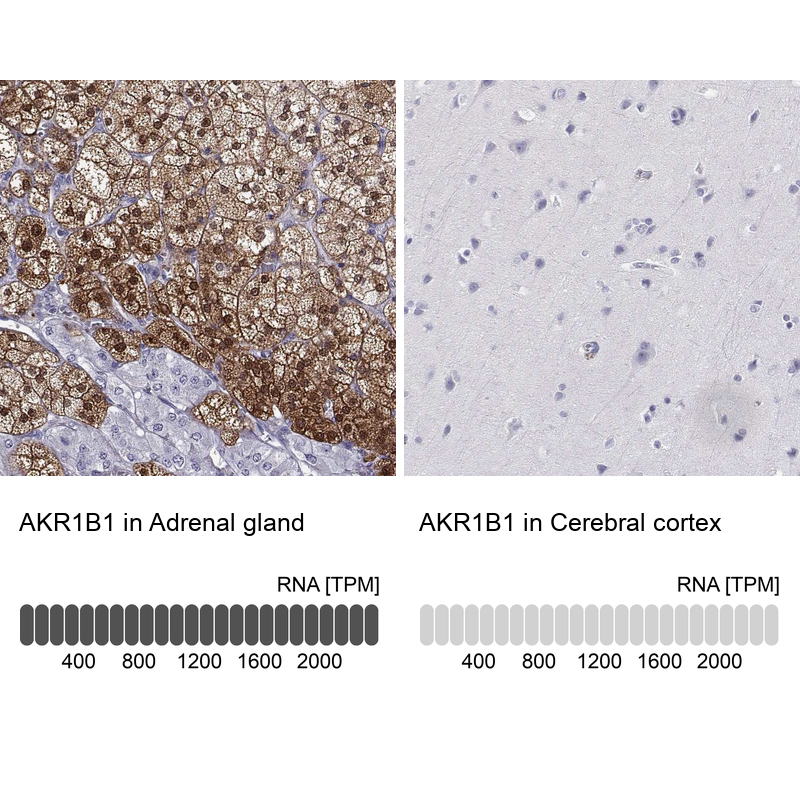 Anti-AKR1B1 Antibody