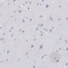Immunohistochemical staining of human cerebral cortex shows low expression as expected.
