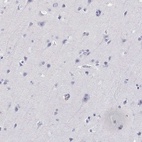 Anti-AKR1B1 Antibody