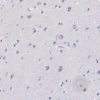 Immunohistochemical staining of human cerebral cortex shows low expression as expected.