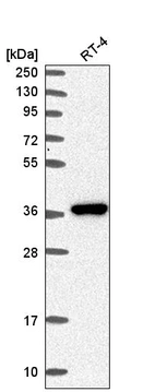 Western blot analysis in human cell line RT-4.