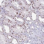 Immunohistochemical staining of human kidney shows strong nuclear positivity in cells in tubules.
