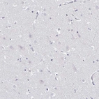 Immunohistochemical staining of human cerebral cortex shows no positivity in neurons as expected.