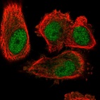 Immunofluorescent staining of human cell line PC-3 shows localization to nucleoplasm & cytosol.