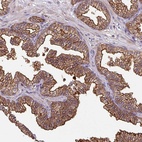 Anti-CENPBD1 Antibody