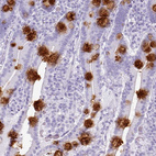 Immunohistochemical staining of human duodenum shows strong cytoplasmic positivity in goblet cells.