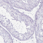 Immunohistochemical staining of human testis shows no positivity in cells in seminiferous ducts as expected.