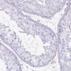 Immunohistochemical staining of human testis shows no positivity in cells in seminiferous ducts as expected.