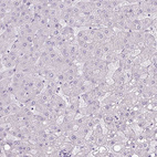 Immunohistochemical staining of human liver shows no positivity in hepatocytes as expected.