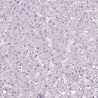 Immunohistochemical staining of human liver shows no positivity in hepatocytes as expected.