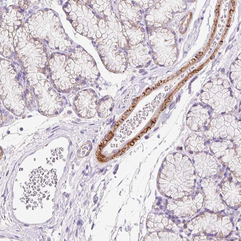 Anti-SUSD5 Antibody