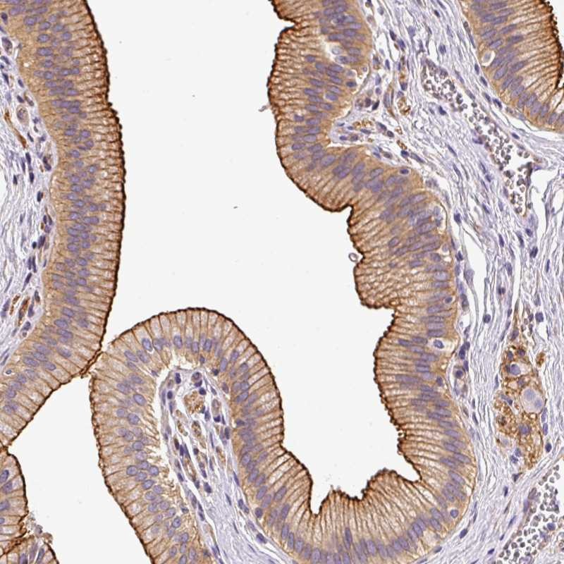Anti-OR11H4 Antibody