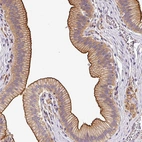 Anti-OR11H4 Antibody