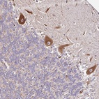 Anti-CPD Antibody