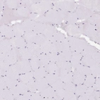 Immunohistochemical staining of human skeletal muscle shows low expression as expected.
