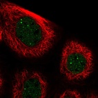 Immunofluorescent staining of human cell line A-431 shows localization to nucleoplasm & nuclear bodies.