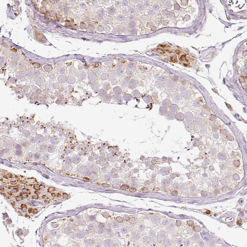 Anti-PAQR9 Antibody