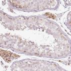 Anti-PAQR9 Antibody