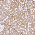 Immunohistochemical staining of human liver shows moderate cytoplasmic positivity in hepatocytes.