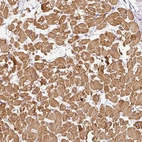 Immunohistochemical staining of human heart shows moderate cytoplasmic positivity in cardiomyocytes.