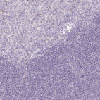 Anti-PAQR9 Antibody
