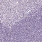Immunohistochemical staining of human tonsil shows no cytoplasmic positivity in lymphoid cells as expected.