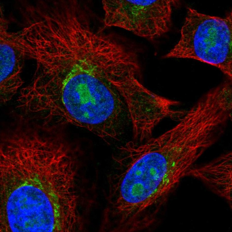Anti-PDGFRL Antibody