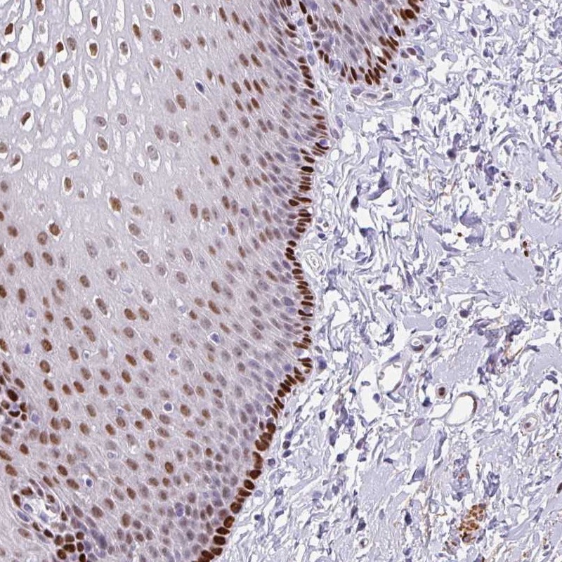 Anti-TMEM215 Antibody