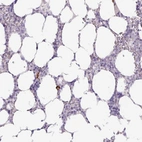 Anti-ADGRE1 Antibody