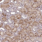 Anti-TRIP6 Antibody