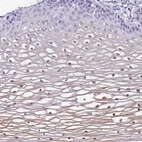Immunohistochemical staining of human cervix, uterine shows positivity in squamous epithelial cells.