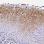 Immunohistochemical staining of human skin shows moderate positivity in squamous epithelial cells.