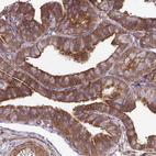 Immunohistochemical staining of human fallopian tube shows strong cytoplasmic positivity in glandular cells.
