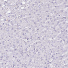 Immunohistochemical staining of human liver shows no positivity in hepatocytes as expected.