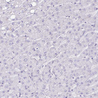 Anti-NCCRP1 Antibody
