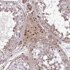 Immunohistochemical staining of human testis shows strong nuclear positivity in Leydig cells.